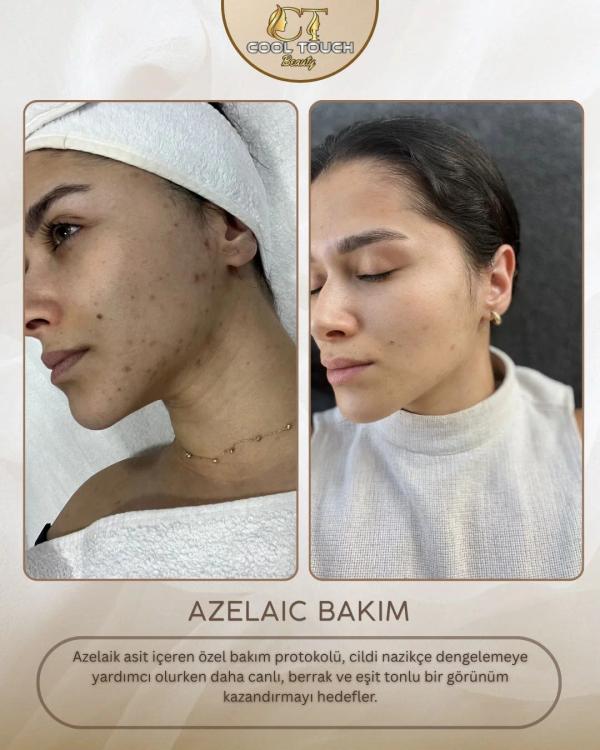 COOLTOUCH BEAUTY
