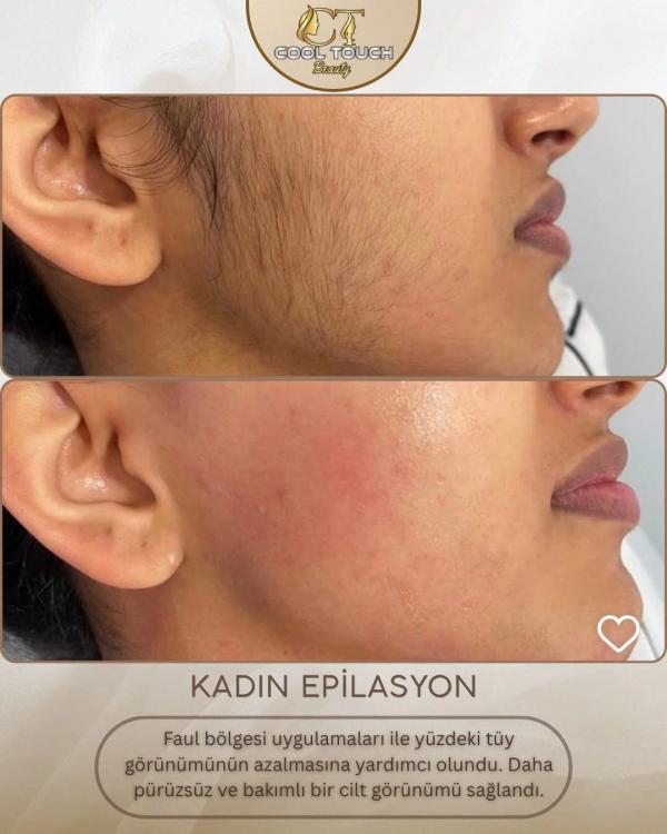 COOLTOUCH BEAUTY