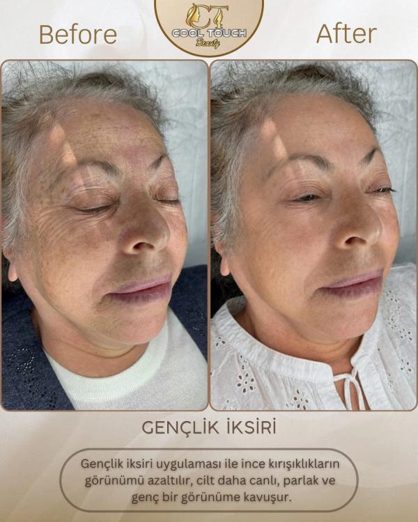 COOLTOUCH BEAUTY